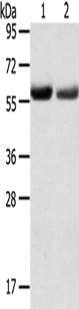 SLC16A9