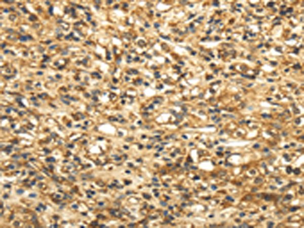 SLC6A19