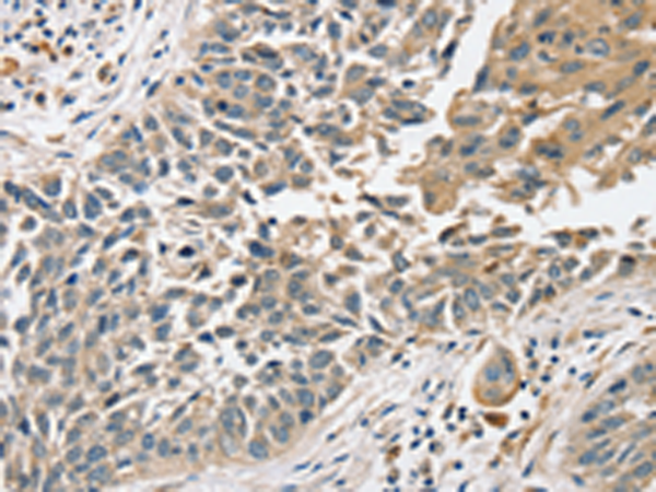 Rabbit Polyclonal Antibody to SLC8A3