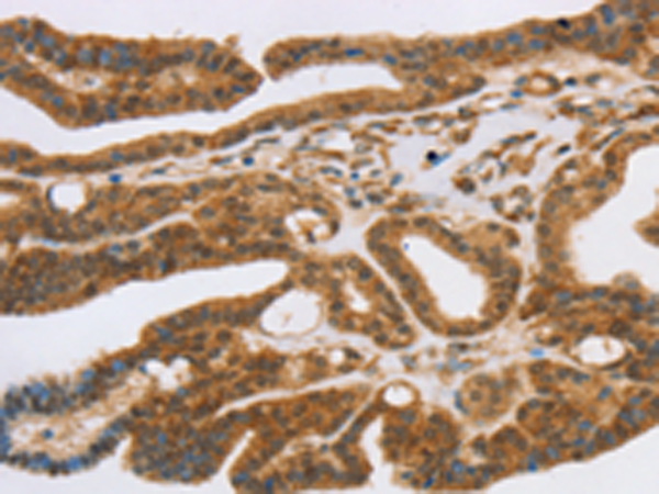 Rabbit Polyclonal Antibody to SLC7A9