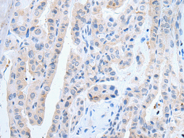 SLCO2B1