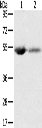 SLC13A3