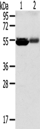 SLC17A1
