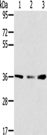 SMN1