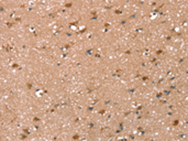 SYNPO2