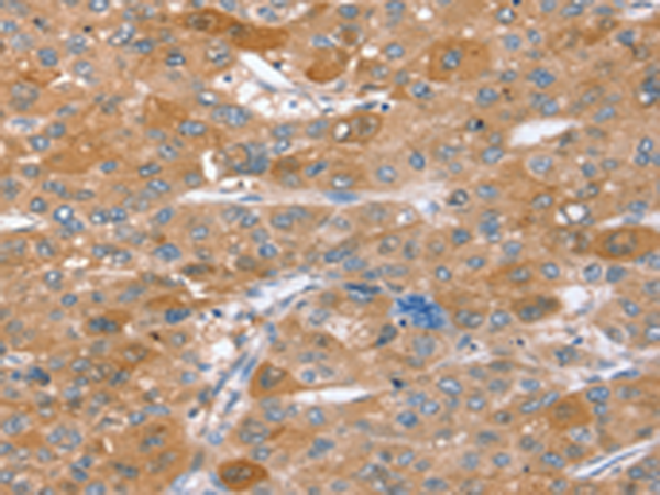 Rabbit Polyclonal Antibody to STX2