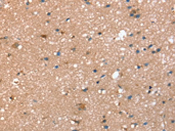 Rabbit Polyclonal Antibody to STX2