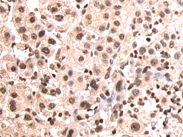 Rabbit Polyclonal Antibody to VMP1