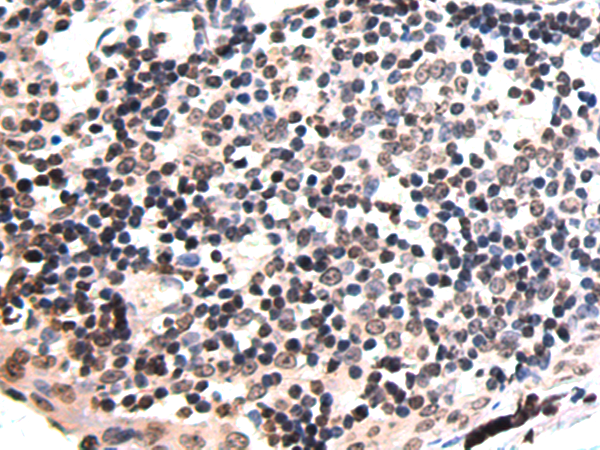 Rabbit Polyclonal Antibody to VMP1