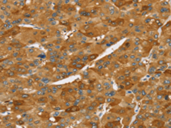 Rabbit Polyclonal Antibody to TNFSF15