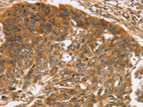 Rabbit Polyclonal Antibody to TNFSF15