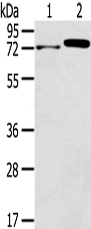 TNIP1