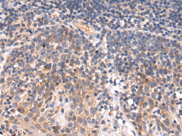 Rabbit Polyclonal Antibody to CSPG4
