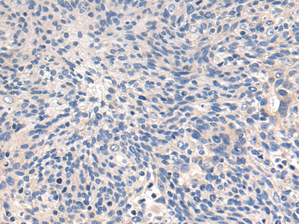 Rabbit Polyclonal Antibody to CSPG4