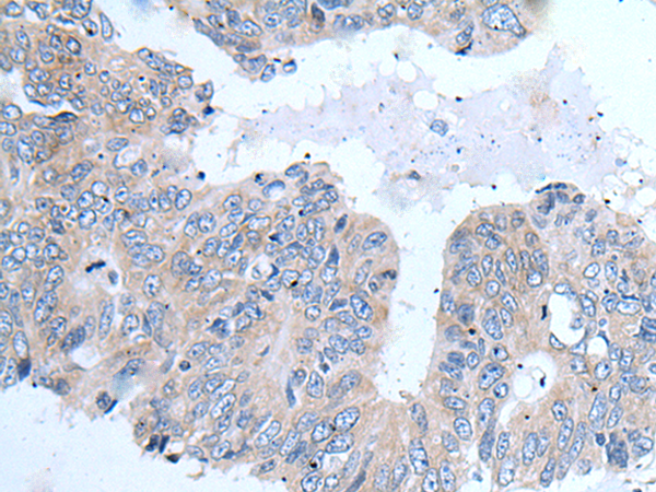 Rabbit Polyclonal Antibody to TRPC5