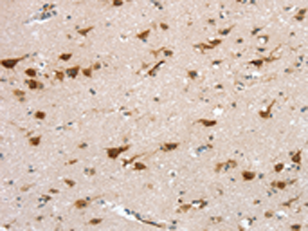 Rabbit Polyclonal Antibody to TRPM6