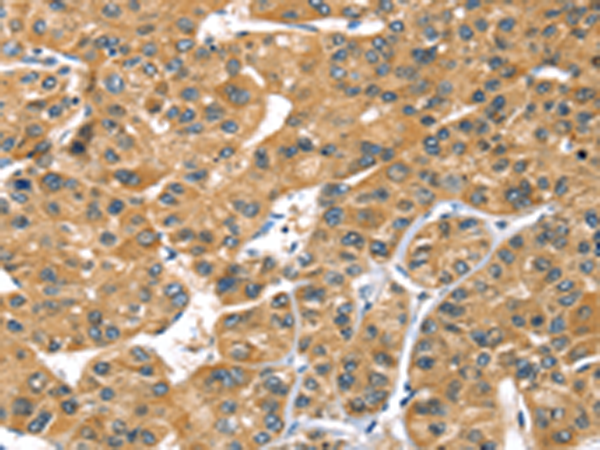 Rabbit Polyclonal Antibody to PRSS50