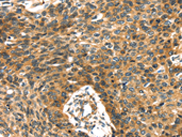 Rabbit Polyclonal Antibody to PRSS50