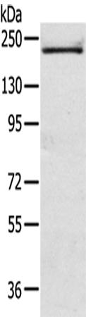 TSC2