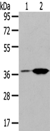 TBXA2R
