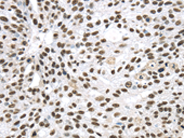 Rabbit Polyclonal Antibody to DDX39B