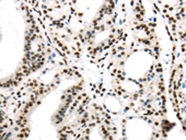 Rabbit Polyclonal Antibody to DDX39B