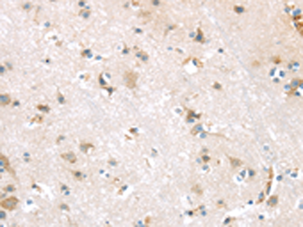 Rabbit Polyclonal Antibody to DKK1