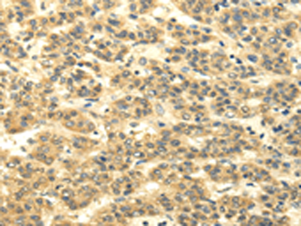 Rabbit Polyclonal Antibody to MSI1