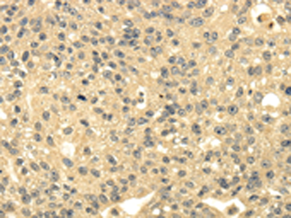 Rabbit Polyclonal Antibody to MSI1