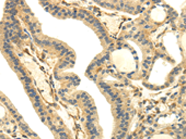 UHRF1BP1