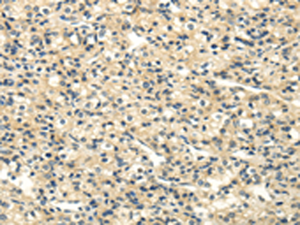 Rabbit Polyclonal Antibody to UHRF1BP1