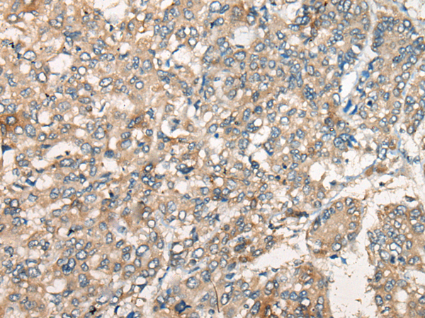 Rabbit Polyclonal Antibody to PPARG