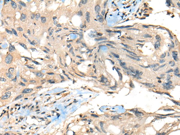Rabbit Polyclonal Antibody to PPARG