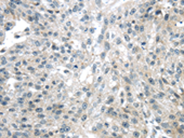 ULBP1