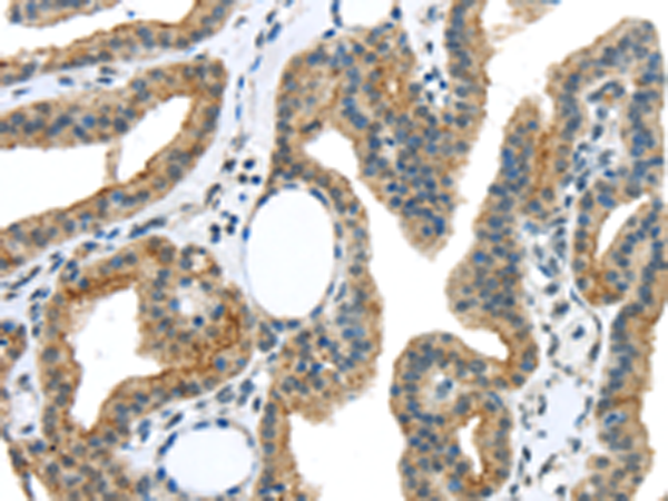 Rabbit Polyclonal Antibody to VAMP2