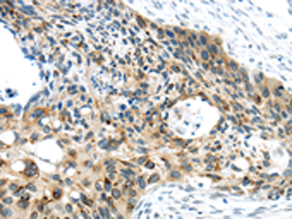 Rabbit Polyclonal Antibody to VAMP2