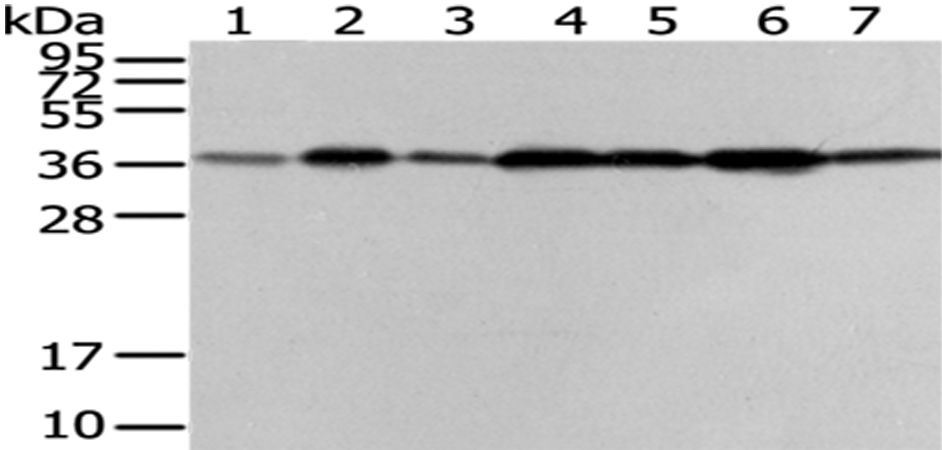VPS26A