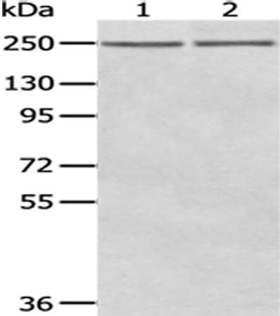 WNK2