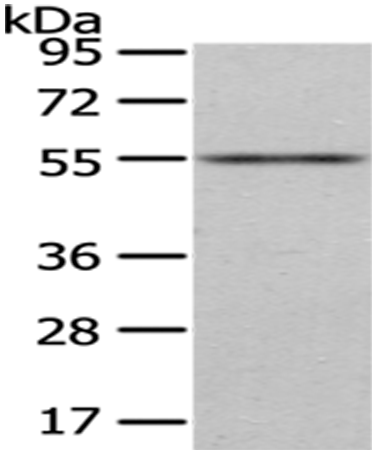 ENTPD1