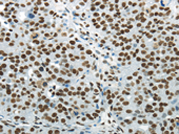 Rabbit Polyclonal Antibody to HNRNPM