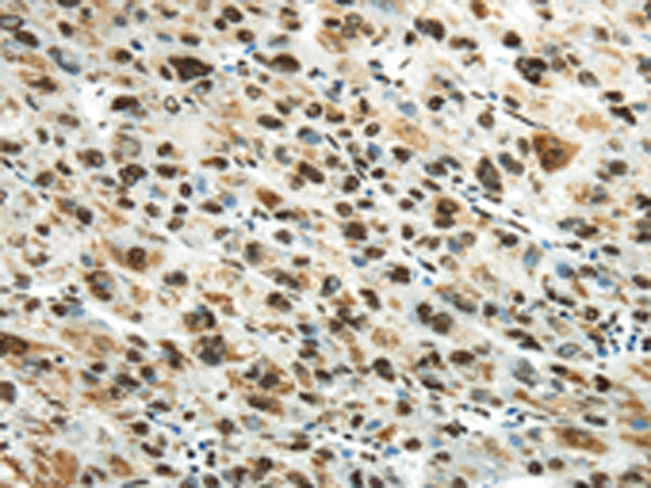 Rabbit Polyclonal Antibody to HNRNPM