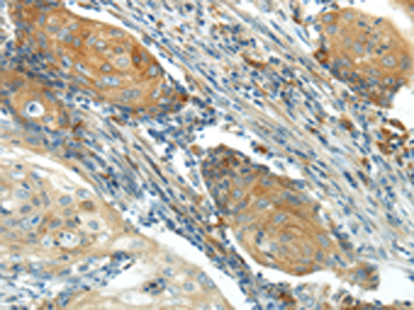 Rabbit Polyclonal Antibody to IL20