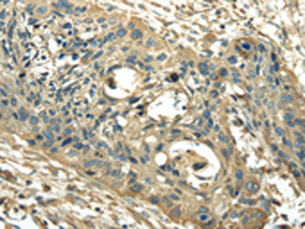 Rabbit Polyclonal Antibody to PKM