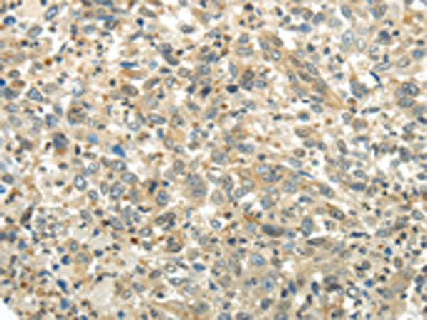 Rabbit Polyclonal Antibody to PKM