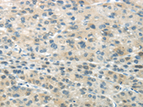 Rabbit Polyclonal Antibody to SMYD2