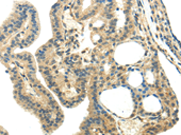 Rabbit Polyclonal Antibody to CHGA 
