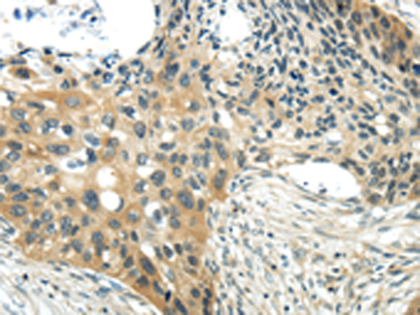 Rabbit Polyclonal Antibody to CHGA 