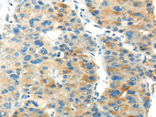 Rabbit Polyclonal Antibody to PDPN