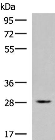 ZFAND2B