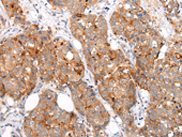 MUC1(CT)